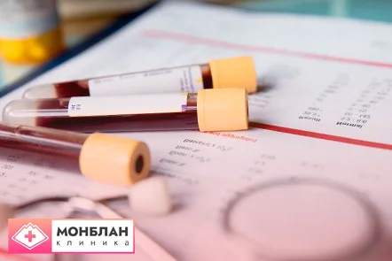 Биохимия и результаты Биохимия и результаты